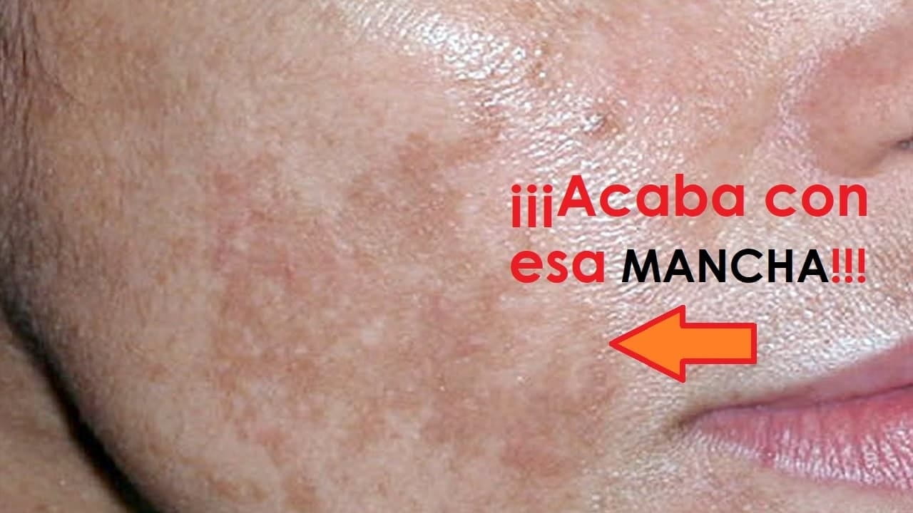 Elimina Las Manchas De La Piel Con Esta Crema Facial De Noche Dios Es